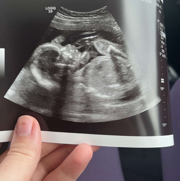 Meet your Posher, Melissa - Picture 4 of 4